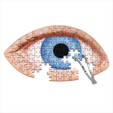 Dry Eye Disease